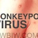 Monkeypox Update: FDA authorizes emergency use of JYNNEOS vaccine to increase vaccine supply