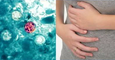 Health Officials Confirm 15 Cases of Parasitic Illness ‘Cyclosporiasis’ in Marion County; No reported cases in Lawrence County at this time